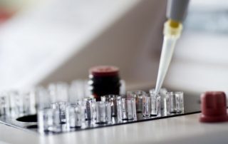 Smear Test in Laboratory about fertility