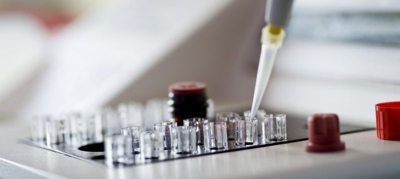Smear Test in Laboratory about fertility